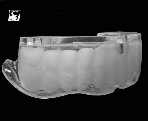 f002Camlog_Vario_SR_Abutments.jpg