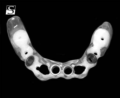 f007Camlog_Vario_SR_Abutments.jpg