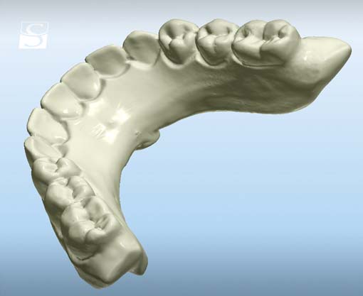f015Camlog_Vario_SR_Abutments.jpg