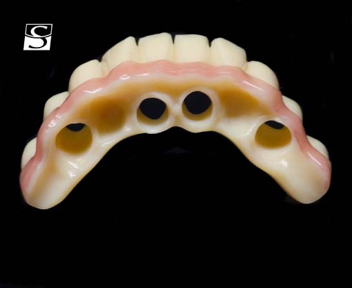 f019Camlog_Vario_SR_Abutments.jpg