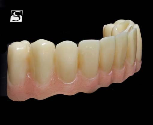f020Camlog_Vario_SR_Abutments.jpg