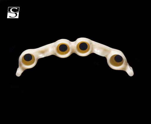 vario001aSchuldes_Camlog_Vario_SR_Abutments.jpg