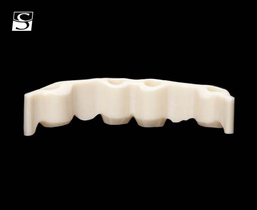 vario002Schuldes_Camlog_Vario_SR_Abutments.jpg