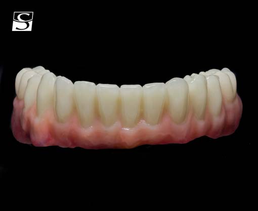 vario008Schuldes_Camlog_Vario_SR_Abutments.jpg