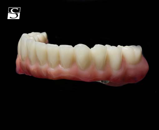 vario010Schuldes_Camlog_Vario_SR_Abutments.jpg